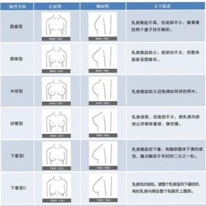 ​五种最常见胸型