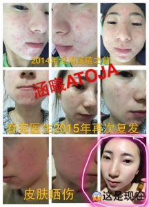 ​涵曦latoja婴儿针官方招代理 打造微商神话