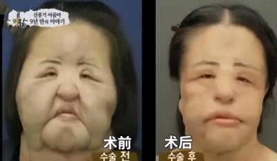 ​韩国女星悲剧：整容成瘾至面目全非，社会审美观念引发深思